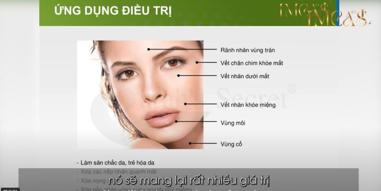 IMCAS | NÂNG CƠ, XÓA NHĂN VÀ THON GỌN KHUÔN MẶT